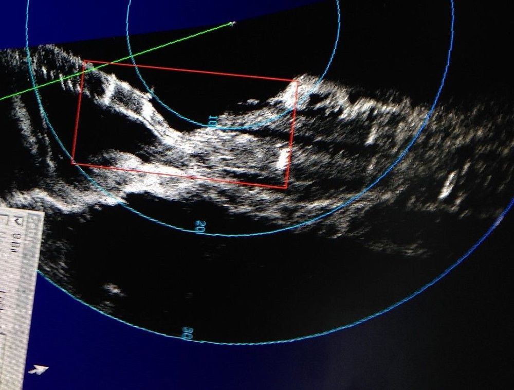Подводная кабелеукладка